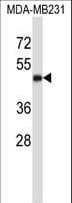 CD1A Antibody (aa75-104)