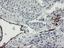 Monoclonal Mouse anti-Human PECAM-1 / CD31 Antibody (clone OTI1C2, IHC, WB)