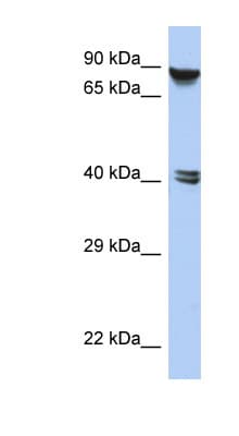 Polyclonal Rabbit anti-Human ZNF429 Antibody (aa143-192, WB)