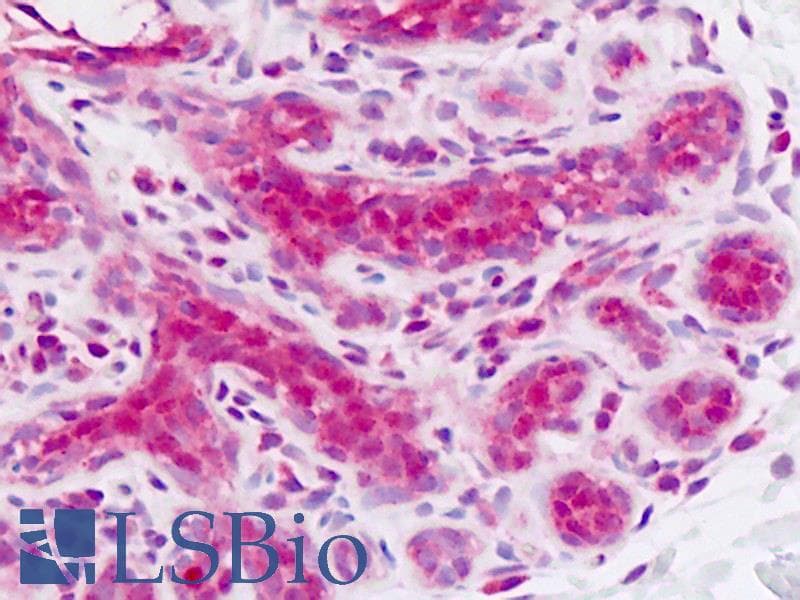 IHC-plus™ CDH4 / R Cadherin Antibody (aa175-203)