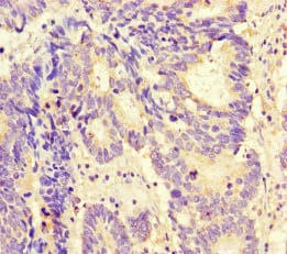 MAX Antibody