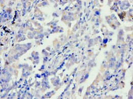 APBB1 / FE65 Antibody (aa361-710)