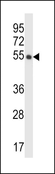 Polyclonal Rabbit anti-Human CRTR1 / TFCP2L1 Antibody (aa14-44, WB)