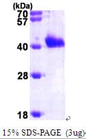 Human GIPC1 / GIPC Protein (Recombinant His)