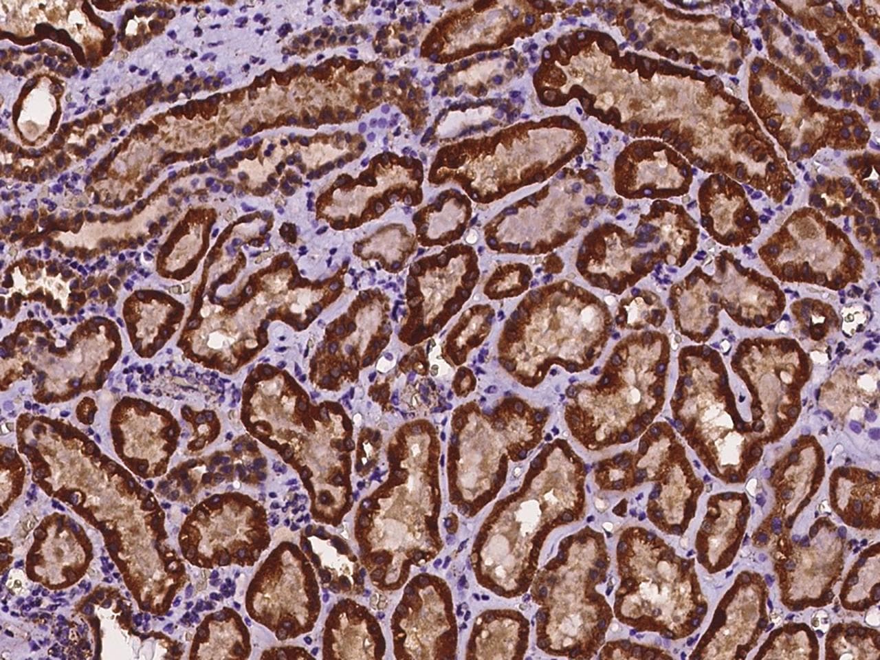 Polyclonal Rabbit anti-Human ACOT9 Antibody (IHC, IF)