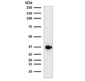 Monoclonal Mouse anti-Human POU2AF1 / BOB1 Antibody (clone BOB1/2421, Azide-free,BSA-free, IHC, WB)