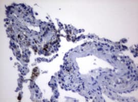 Monoclonal Mouse anti-Human PIK3CD / PI3K Delta Antibody (clone OTI1B5, aa286-610, IHC, WB)