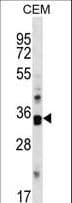 CDK10 Antibody (aa287-314)