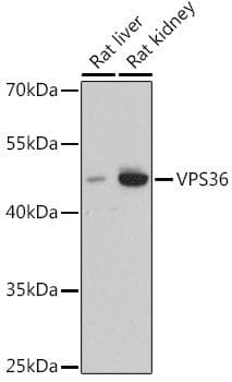 Polyclonal Rabbit anti-Human VPS36 Antibody (IF, WB)