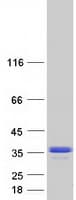 Human USB1 Protein (Recombinant Myc-DDK (Flag))