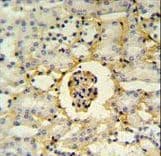 PMPCB / MPP11 Antibody (aa18-46)