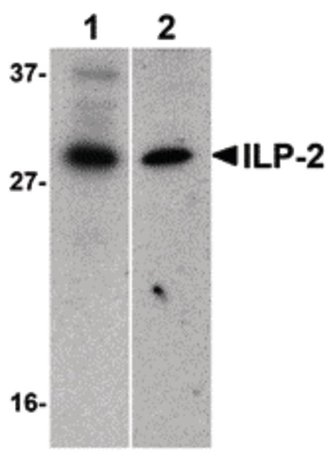 IHC-plus™ Polyclonal Rabbit anti-Human BIRC8 / ILP2 Antibody (IHC, IF, WB)