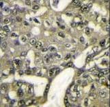 Polyclonal Rabbit anti-Human AKT1 Antibody (aa115-144, IHC, IF, WB)