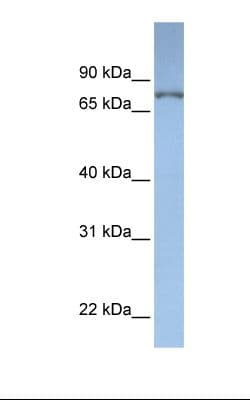 Dipeptidyl Peptidase 3 / DPP3 Antibody (aa38-87, HRP)