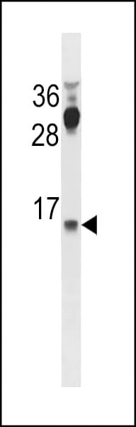 Polyclonal Rabbit anti-Human CYYR1 Antibody (aa96-124, WB)