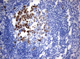MKI67 / Ki67 Antibody (aa1160-1493, clone OTI5D5)