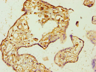 AMPD3 Antibody (aa1-260)