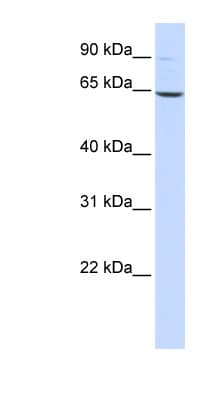 LTA4H / LTA4 Antibody (aa467-516)