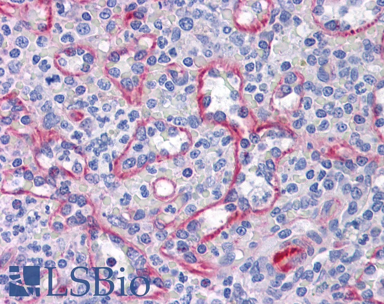 IHC-plus™ SLC44A2 / CTL2 Antibody (clone 3D11)