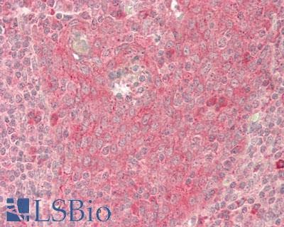 DSG3 / Desmoglein 3 Antibody (aa854-903)