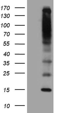 Monoclonal Mouse anti-Human C5orf56 Antibody (clone OTI10A6, WB)