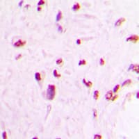 Polyclonal Rabbit anti-Human MEF2C Antibody (C-Terminus, IHC, IF, WB)