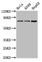 TGM2 / Transglutaminase 2 Antibody