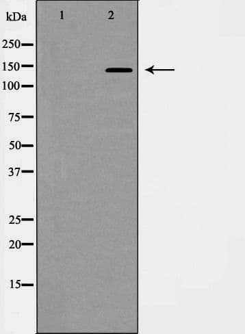 PDGFRA / PDGFR Alpha Antibody