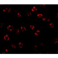 IHC-plus™ Polyclonal Rabbit anti-Human SPTLC2 / LCB2 Antibody (IHC, IF, WB)