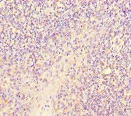 SCPEP1 / RISC Antibody
