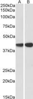 IHC-plus™ CAPG Antibody (aa205-217)