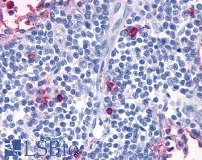 PathPlus™ Polyclonal Rabbit anti-Human CCR7 Antibody (Extracellular Domain, IHC)