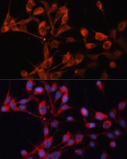 Polyclonal Rabbit anti-Human SLC25A19 Antibody (IF)