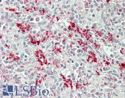 IHC-plus™ Polyclonal Rabbit anti-Human E4 / UBE4A Antibody (N-Terminus, IHC, WB)