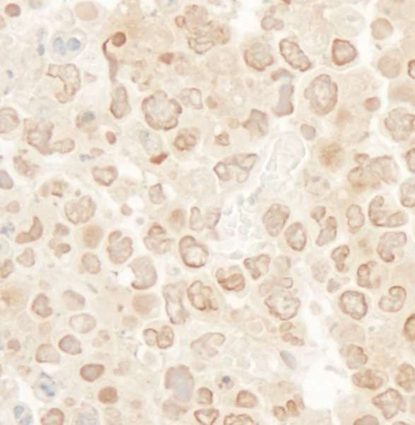 KIF2C / MCAK Antibody (aa50-100)