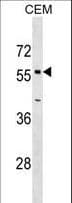 OPTN / Optineurin Antibody (aa71-96)