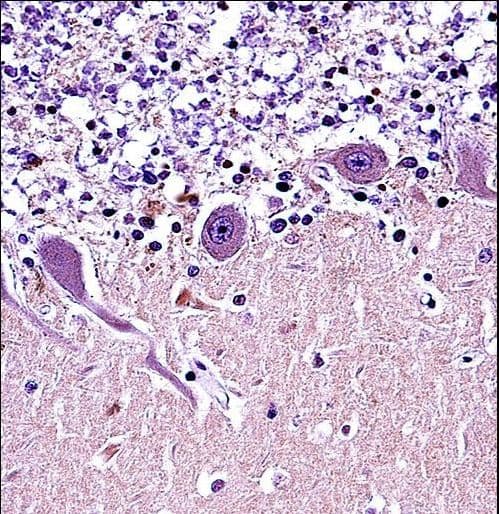 CRMP1 Antibody (aa82-110)