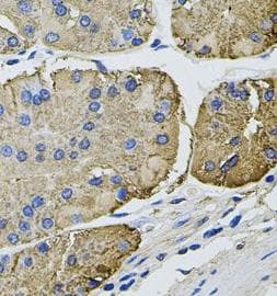 THBS2 / Thrombospondin 2 Antibody