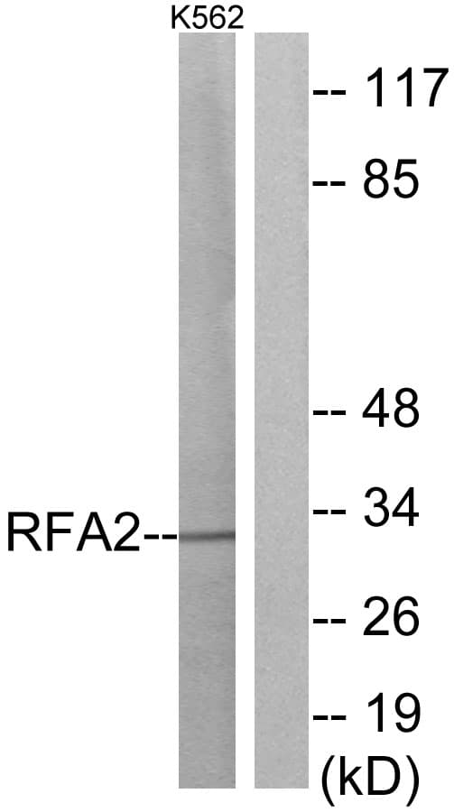 RPA2 / RFA2 / RPA34 Antibody (aa10-59)