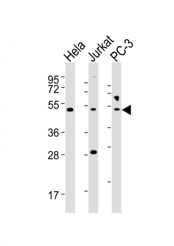 NFKBIE / IKB Epsilon Antibody (aa191-224)