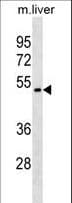 TROP2 / TACSTD2 Antibody (aa218-246)