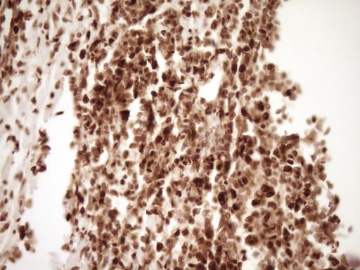SAE1 Antibody (clone OTI6C7)