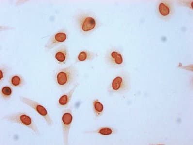 HIST1H3A Antibody