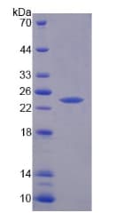 Rat RIPK1 / RIP Protein (Recombinant His-T7)