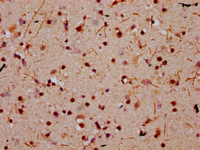 HIST1H2BN Antibody