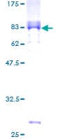 Human PAX8 Protein (Recombinant GST)
