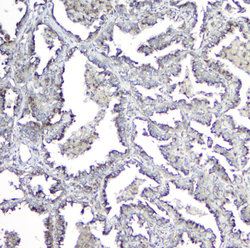 Mannose Phosphate Isomerase Antibody