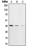 Polyclonal Rabbit anti-Human POLB / DNA Polymerase Beta Antibody (C-Terminus, IHC, WB)