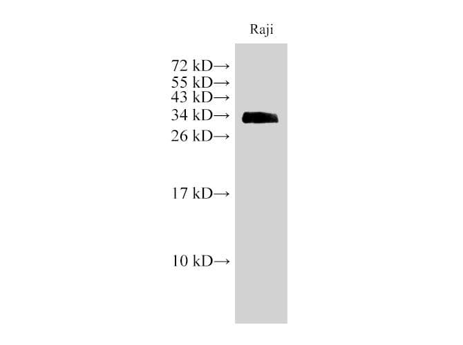 CD74 / CLIP Antibody