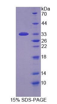 Human PADI1 Protein (Recombinant His-T7, N-terminus)